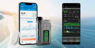 Revoluce v léčbě cukrovky: Když technologie pracují za vás