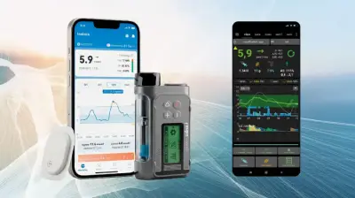 Revoluce v léčbě cukrovky: Když technologie pracují za vás